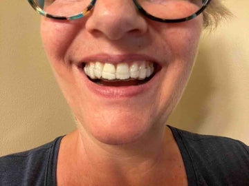 Thousands of satisfied customers and 5 star reviews. Protect your teeth from teeth grinding, clenching, bruxim with a custom dental night mouth guard. 