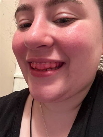 enCore customers swear by their dental night mouth guards for teeth grinding and clenching aka bruxism
